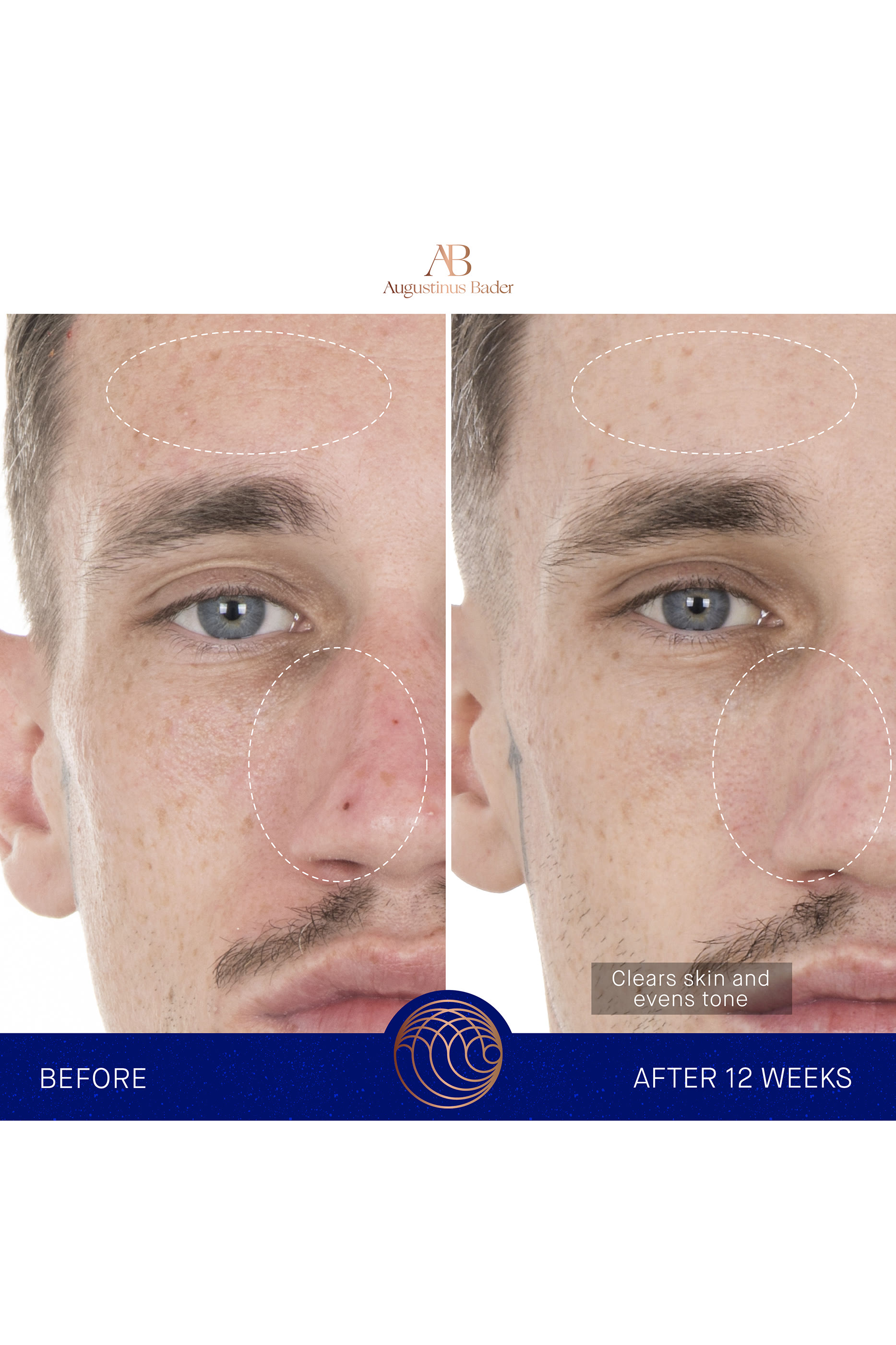 The Retinol Serum