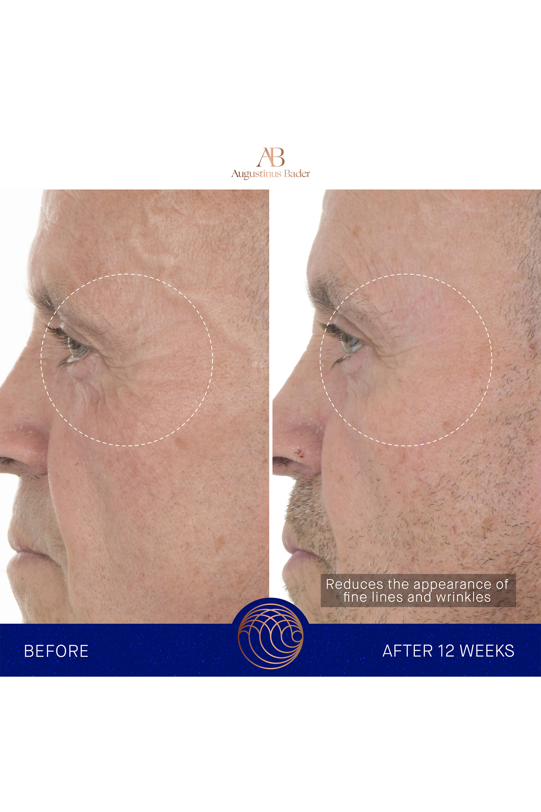 The Retinol Serum