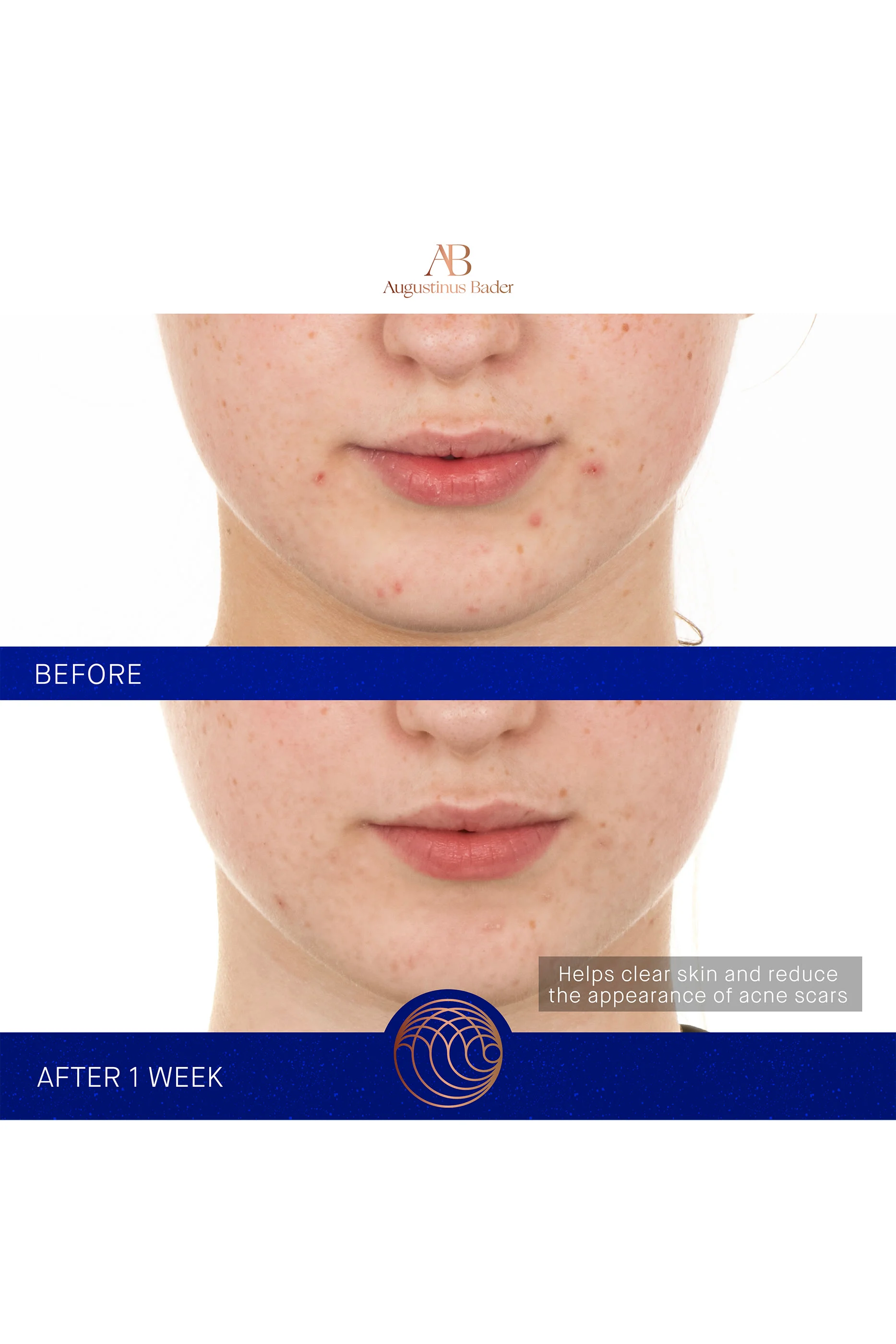 The Retinol Serum