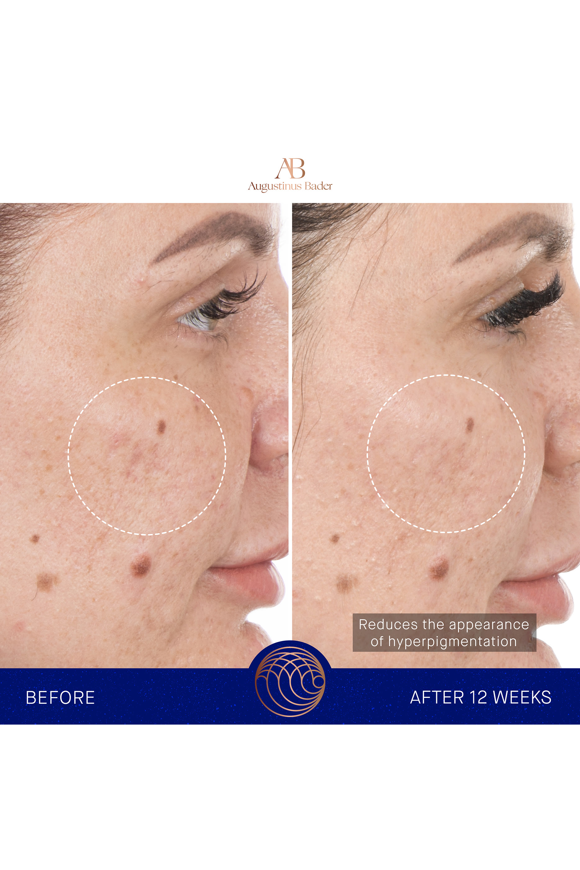 The Retinol Serum